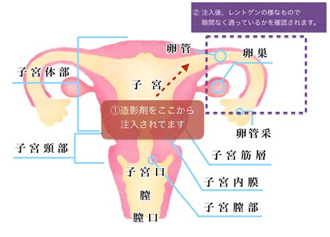 卵管閉塞の変化！体外受精から自然妊娠へ Totell（トテル）｜佐賀の妊活コンディショニングサロン