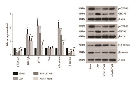 Effect of rTMS on the activities of GSK 3β Tau and β catenin in AD