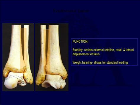 PPT - Ankle Fracture Update PowerPoint Presentation, free download - ID:3424187