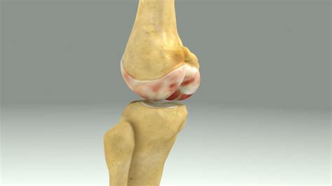 6 Best Exercises For Knee Cartilage Loss - Feel Good Life