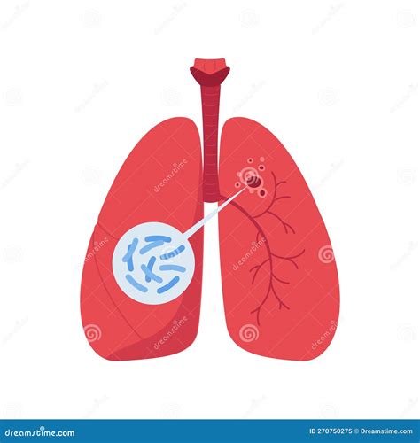 Tuberculosis Disease Concept Vector Flat Healthcare Illustration Red