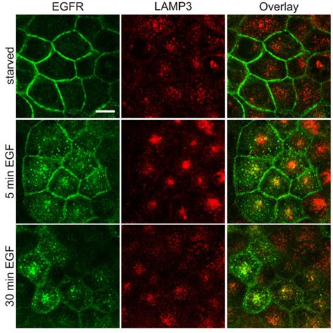 Egfr Endocytosis Is Not Impaired Upon Flotillin Depletion Staining