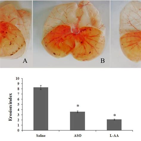 Gastric Mucosal Damage Induced By Restraint Water Immersion Stress