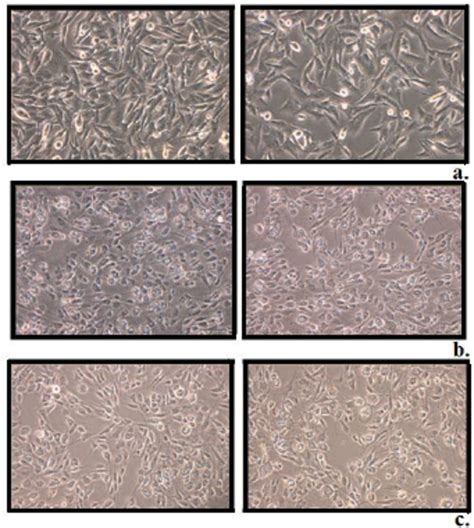 Fields Of Untreated C32 Cells A And C32 Cells Treated With 2 Mg GAE