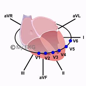 Correlación entre Derivaciones y Paredes Cardiacas, Localización de las Derivaciones