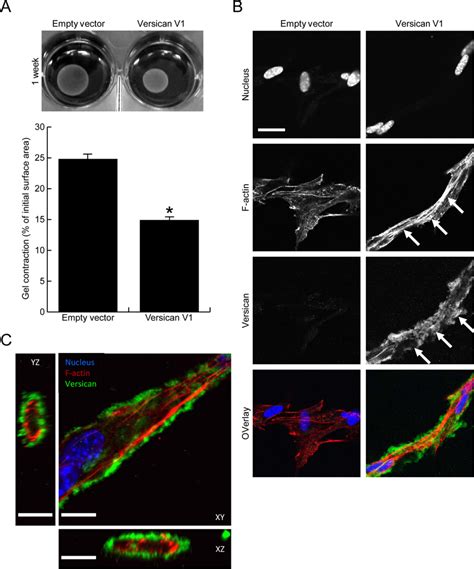 Versican Increases Fibroblast Mediated Contraction Of A Collagen