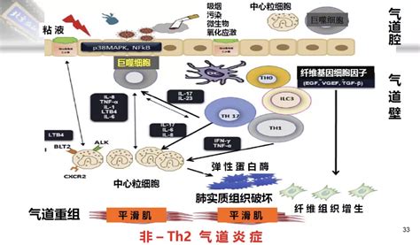 蔡柏蔷教授：哮喘和慢阻肺重叠（aco）尚无明确诊断标准、缺少临床药理研究该如何应对频发、棘手的急性加重？ 学术 呼吸界