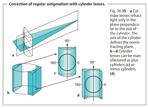 Astigmatism Ray Diagram