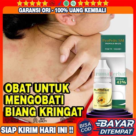 Jual Obat Biang Keringat Gatal Gatal Miliaria Rubra Bintik Bintik Di