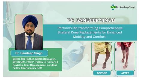 Dr Sandeep Singh Performs Life Transforming Comprehensive Bilateral