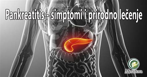 Pankreatitis simptomi i prirodno lečenje Mediflora