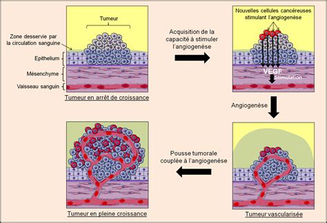 Dossier Langiogenèse du tissu tumoral