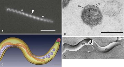 Syphilis Treponema Pallidum Oncohema Key