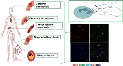 Frontiers The Emerging Role Of Neutrophil Extracellular Traps In