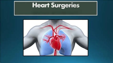 Ppt Heart Surgeries Powerpoint Presentation Free Download Id 7327467