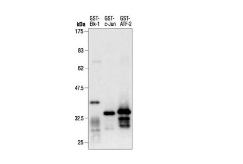 Gst Tag Antibody Cell Signaling Technology