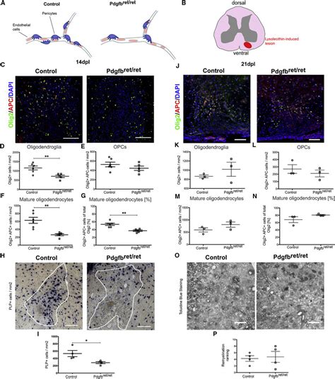 Opc Differentiation Is Affected During Remyelination In Pdgfb Ret Ret