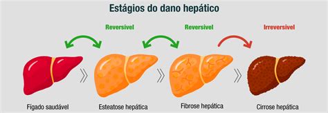 Voc Sabe Como O Organismo Reage Ao Consumo De Lcool