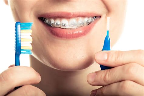 Art Culos En Brackets Axioma Estudi Dental