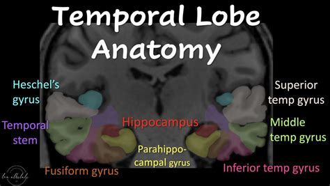 1is Your Ability To Remember Temporal Lobe Anatomy Seem Well