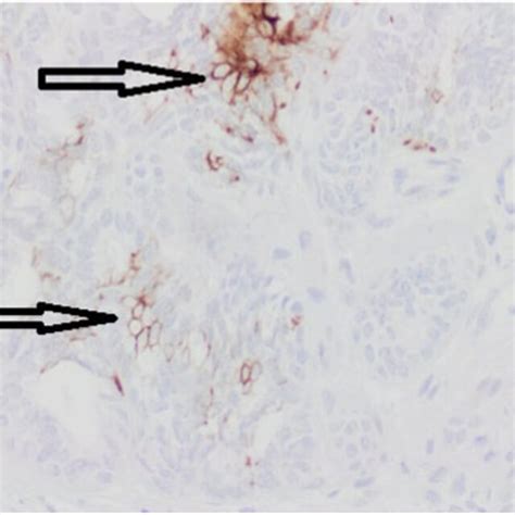 CK7 Immunohistochemistry Expression Arrows Medium Power At 10 X