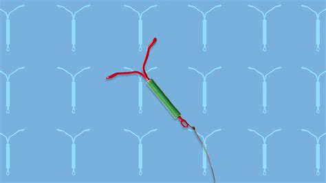 Iud Insertion Process How Much Does It Hurt To Get An Iud Marie Claire