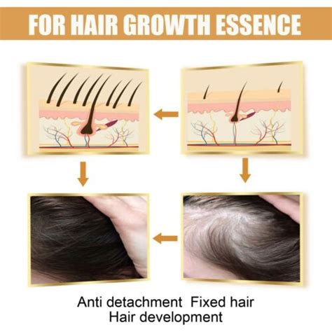 Fermented Rice Water Serum Hair Growth Rice Water Ubuy India