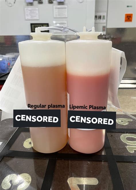 Grifols express kiosk downtime causes major delays for plasma donors 6