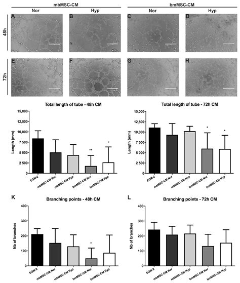 Ijms Free Full Text Intrinsic Angiogenic Potential And Migration