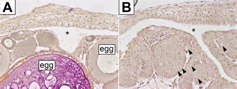 Inherent Feminizing Effect Of Germ Cells New Insights Into Sex