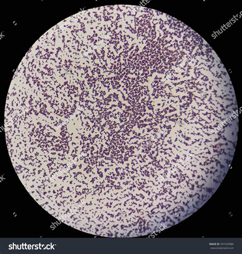 Gram Positive Cocci Under Microscope