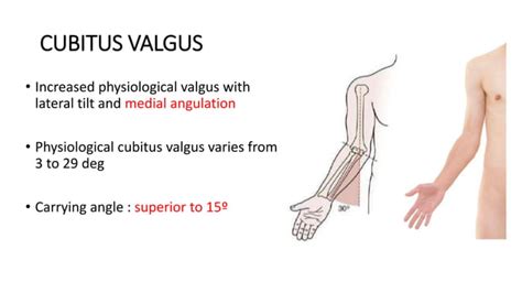 Cubitus valgus varus | PPT