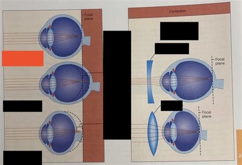 Exam 1 Special Senses Visual Tests Chapter Diagrams Flashcards Quizlet