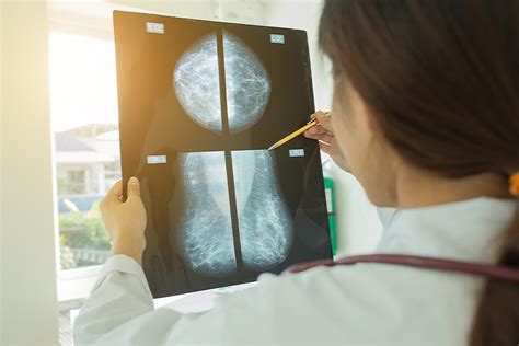 The Benefits Of A Mammogram And Why You Should Get One