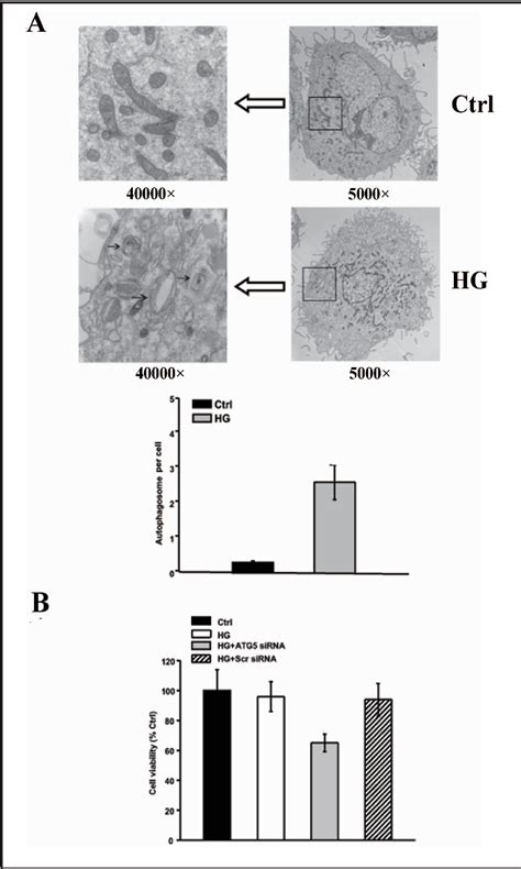 Figure 1 From Regulation Of Autophagy By High Glucose In Human Retinal