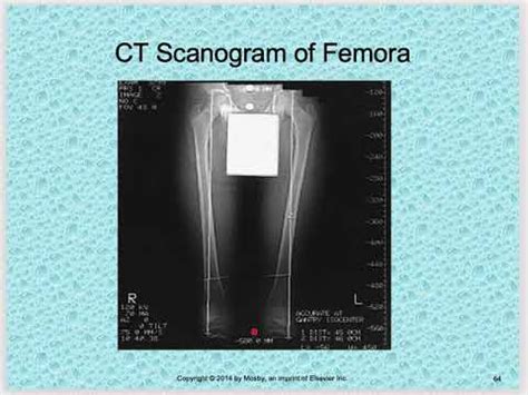 Special Radiographic Procedures Youtube