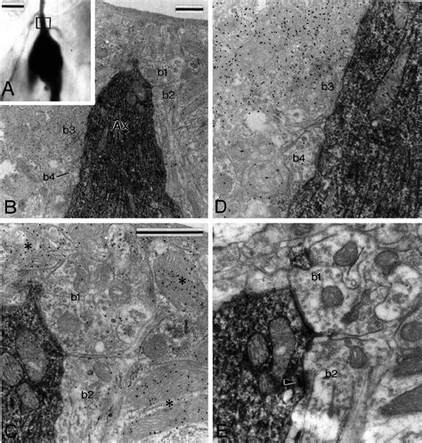 Correlated Light A And Electron BE Micrographs Showing