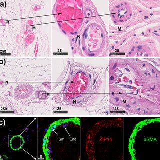 Immunolocalization Of Multiple Metallothioneins In Microvessels A Mt