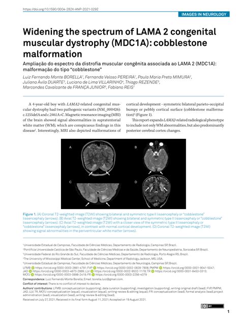 PDF Widening The Spectrum Of LAMA 2 Congenital Muscular Dystrophy