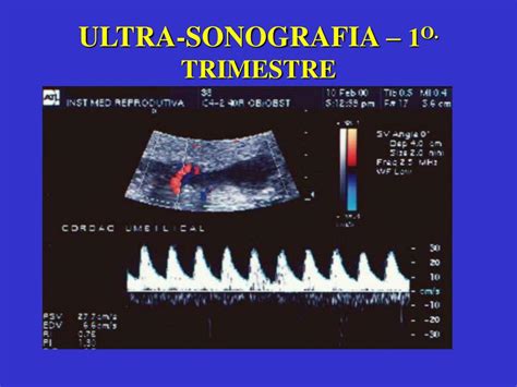 PPT Ultra som em Obstetrícia Primeiro trimestre Segundo trimestre