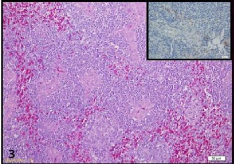 Lymphoid Hyperplasia Spleen Even Though The Splenic Tissue Maintained Download Scientific