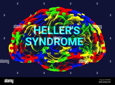 Heller S Syndrome Conceptual Illustration Stock Photo Alamy