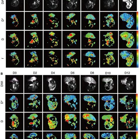 Ivim Dwi Mri Features Of The Ct Colon Cancer Mouse Model In The