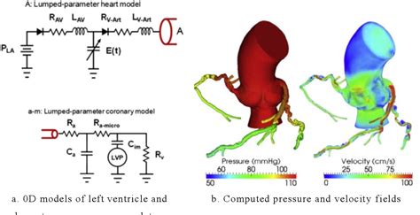 Figure From Patient Specific Blood Flow Modelling In Diagnosis Of