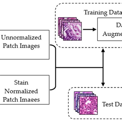 Workflow Of Stain Normalized Images Classification Using Diverse Deep