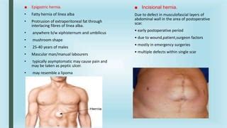 VENTRAL WALL HERNIA.pptx