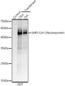 Anti SARS CoV 2 Nucleoprotein Rabbit Monoclonal Antibody Clone