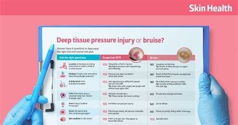 Deep tissue pressure injury vs. bruise: Know the differences