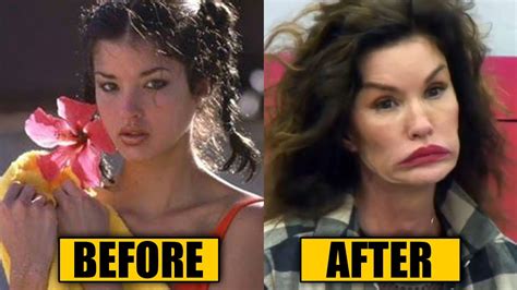 20 Celebrities Plastic Surgery Disasters Celebs Who Look Unrecognizable After Plastic Surgery