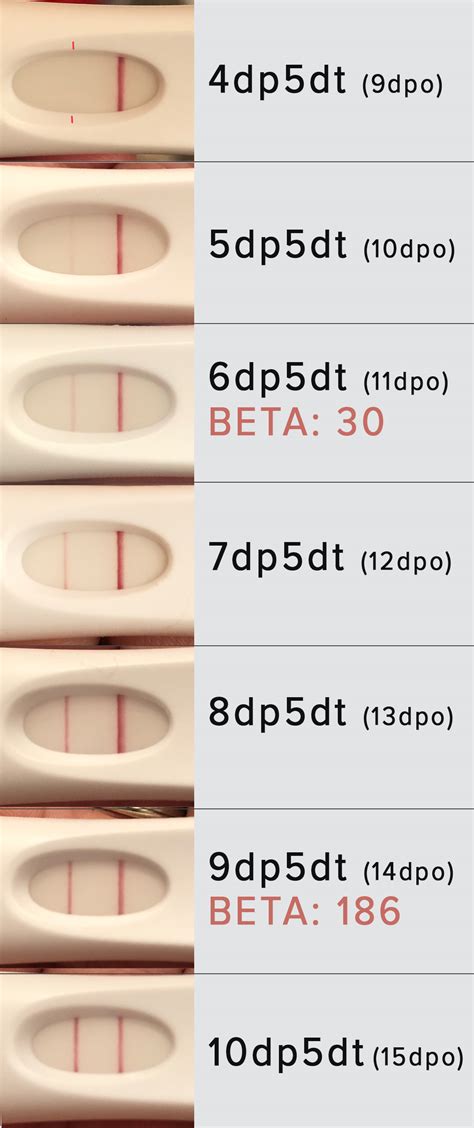 Fet 5 Line Progression This Is Ivf Pregnancy 3 After Two Losses Last Year I M Really Really